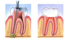 Jerry Tennant Teeth Chart